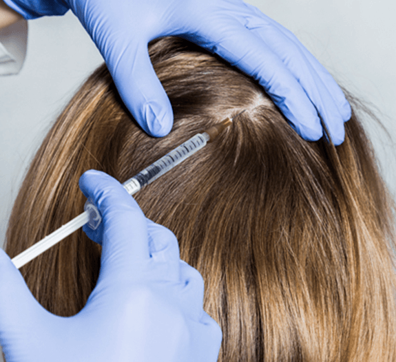 Hair Transplant in Noida  Hair Loss Treatment Cost  Clinics